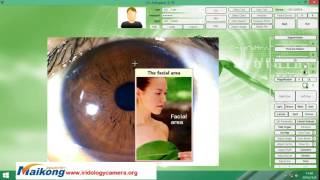 HOW TO USE THE ENGLISH PRO IRIDOLOGY SOFTWARE Video [upl. by Enoid557]