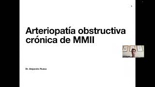 Arteriopatía Obstructiva Crónica MMII  Pregrados [upl. by Dlareme]