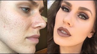 Does Primer Do Anything For Acne  Cassandra Bankson [upl. by Nancy]