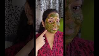 ✅How To Remove Acneamp Pimples With Neem Leaves 💯Natural Face Packskincare ytshorts shorts [upl. by Rayshell]