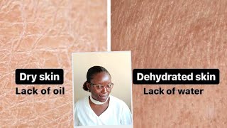 DRY SKIN VS DEHYDRATED SKIN  Causes Treatment Prevention [upl. by Rebecca]