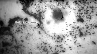 Removal of a biofilm by ultrasound microbubbles [upl. by Aeslehc]