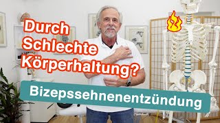 Bizepssehnenentzündung ⚡ Durch schlechte Körperhaltung  Übungen und Tipps [upl. by Wilie]