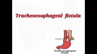 Tracheoesophageal fistula mrcpch Communication [upl. by Risan974]