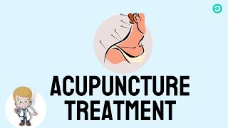 ACUPUNCTURE For Lower Back Pain [upl. by Sul]