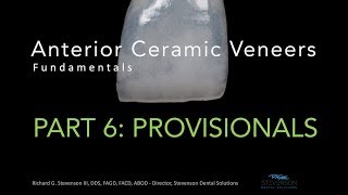 Anterior Ceramic Veneers Part 6 Provisionals [upl. by Toole]