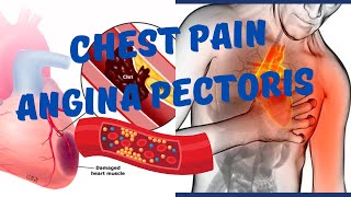 Angina Pectoris ll Chest Pain ll Common symptom of Heart Disorders ll BSc Nursing  MSc Nursing [upl. by Yaresed]