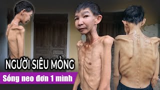 Người đàn ông siêu mỏng sống neo đơn 1 mình chống chọi với căn bệnh quái ác [upl. by Annaihs466]