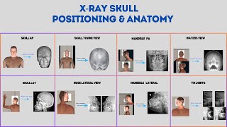 How to take skull xray positions and anatomy xrays xraytechnician skull skullandbones [upl. by Akirdnas]