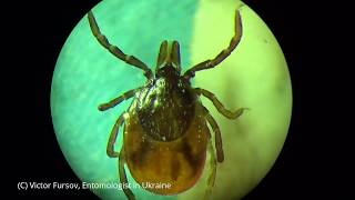 Dogs Tick Ixodes ricinus in Kiev Ukraine X 200 Under Microscope [upl. by Aysan]