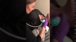 TempSure Envi RF Neck skin tightening [upl. by Robinett]