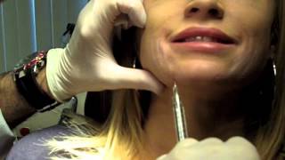 Cannula Method for Fillers  Dr Nissan Pilest Irvine CA [upl. by Raffaello]