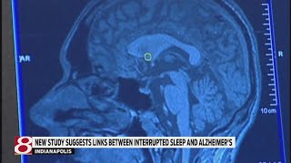 New study suggests link between interrupted sleep and Alzheimers disease [upl. by Eiramait]