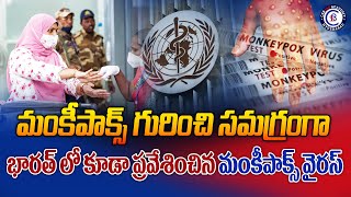 మంకీపాక్స్ గురించి సమగ్రంగా భారత్ లో కూడా ప్రవేశించిన మంకీపాక్స్ వైరస్ monkeypox virus news [upl. by Fadil]