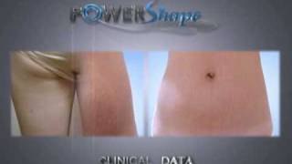 POWERSHAPE wwwpowershapecom non invasive body contouring using Rflaservacuum [upl. by Panter456]