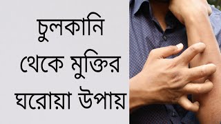 চুলকানি দূর করার ঘরোয়া উপায়  Home Remedies for Itching  Chulkani  HealthLifeBanglabi8wv [upl. by Jeanne]