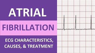 Atrial Fibrillation AFib ECG Treatment Causes Nursing NCLEX Review ACLS [upl. by Sinclair]