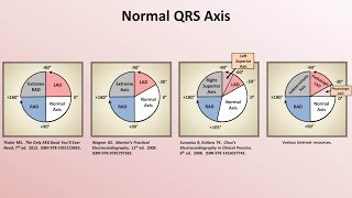 Intro to EKG Interpretation  Rate and Axis [upl. by Spring]