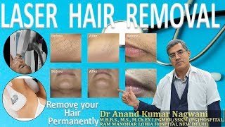 Laser Hair Removal In Kolkata I Laser Hair Removal Cost In Kolkata [upl. by Sila]