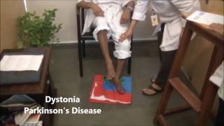 Understanding Dystonia Symptoms in Parkinsons Disease  Dr Paresh Doshi [upl. by Sanjiv]