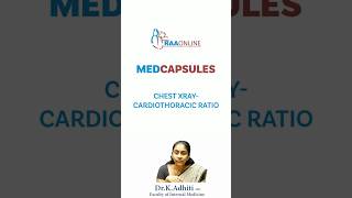 MEDCAPSULES  Chest XRay Cardiothoracic ratio  By DrKAdhiti [upl. by Wassyngton]