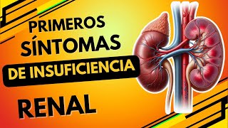 PRIMEROS SÍNTOMAS de INSUFICIENCIA RENAL [upl. by Lise110]