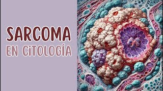 Sarcoma en citología [upl. by Betsy129]