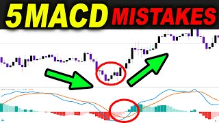 5 MACD Strategy MISTAKES you should avoid in Trading Forex Stocks or  Forex Day Trading [upl. by Atronna]