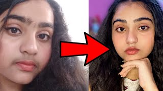 Teenage Facial Hair Removal with total Natural Ingredients How I removed my Facial Hairs Naturally [upl. by Lilli]