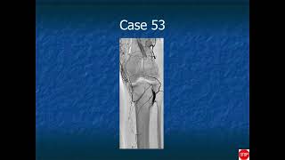 RADIOLOGY EXAM CASES [upl. by Edyaw]