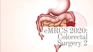 eMRCS 2020 Colorectal Surgery 2 [upl. by Lalittah716]