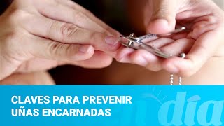 Claves para prevenir uñas encarnadas [upl. by Cantlon448]