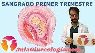 SANGRADO PRIMER TRIMESTRE Diagnóstico diferencial causas ecografía  Ginecología y Obstetricia [upl. by Nyladnarb]