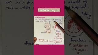 Unstable angina stable angina variant angina angina medical [upl. by Imeon]