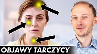 17 oznak że Twoja tarczyca woła o pomoc Niedoczynność tarczycy objawy  Dr Bartek Kulczyński [upl. by Yulma]