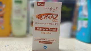 conaz lotion review  medicated shampoo for dandruff and hairfall  conaz for baldness treatment [upl. by Isac]