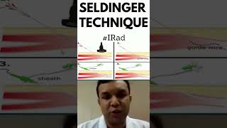 What is Seldinger Technique  Interventional Radiology  Shorts [upl. by Ji]