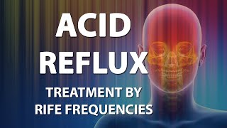 Acid Reflux GERD  RIFE Frequencies Treatment  Energy amp Quantum Medicine with Bioresonance [upl. by Barbour]