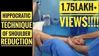 Hippocratic Method of Shoulder Reduction Reduction in less than 5seconds [upl. by Donata373]