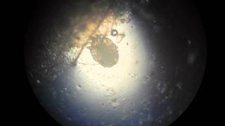 Scabies Mite Video HD [upl. by Spector]