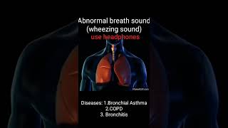 Wheezingabnormal breath soundAsthmaCOPDBronchitisHow to different wheezing soundMed school way [upl. by Tera306]