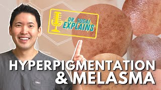 Dermatologist Explains Hyperpigmentation and Melasma  How to Manage it with Top Picks [upl. by Ydnerb]