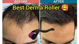 Best Derma Roller Hair Regrowth  Derma Roller At Home  Derma Roller Results [upl. by Ahsieni]