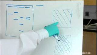 Electrophoresis How to Read Results [upl. by Anippesuig]