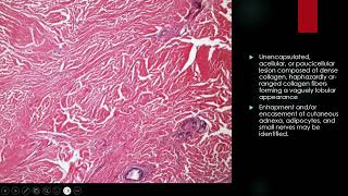 2024 09 17 Nuchal Type Fibroma bstpath [upl. by Ericha582]