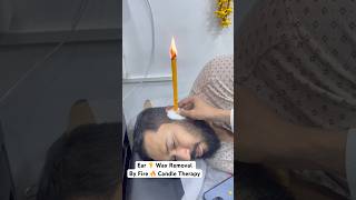 Ear 👂 wax removal by fire 🔥 candle 🕯️ therapy kzhijamaearearwaxremovalshortsreelsytshots [upl. by Kassi]