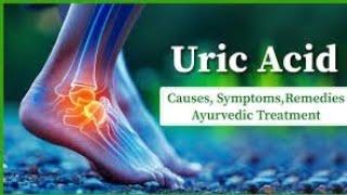 uric Acide se bachne ke 5upayehealthuricacid5 upaye [upl. by Fromma]