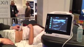 Ultrasound Guided Illeoingunal Nerve Block [upl. by Cello]