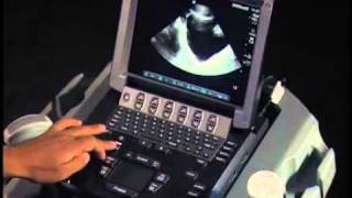 How To Ultrasound FAST Exam  Male Pelvis [upl. by Ezara297]