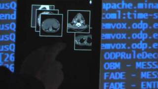 RadSpeech  Multimodales Dialogsystem für Radiologen [upl. by Ahsyekal471]